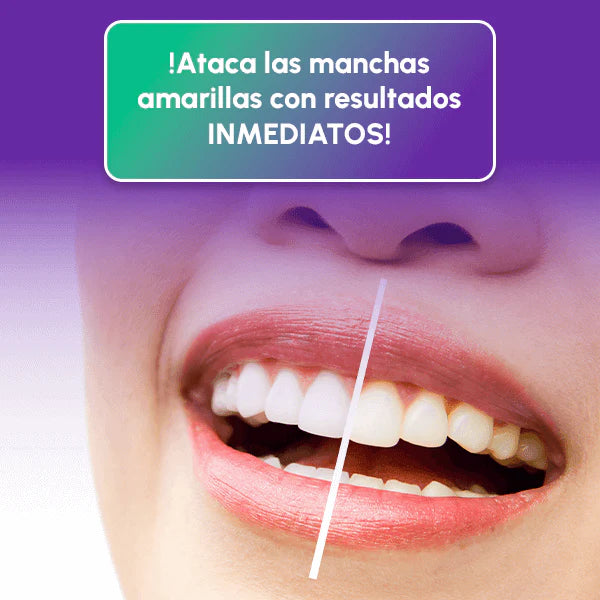 LÁPIZ DENTAL BLANQUEADOR + ENVÍO GRATIS